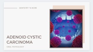 ADENOID CYSTIC CARCINOMA [upl. by Yromas106]