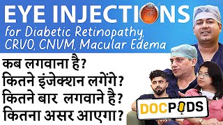 Eye Injections for Retina Treatments Explained  DocPods  Episode 1 [upl. by Stoddart]