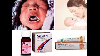 CANDIDÍASE SAPINHO EM BEBÊ TRATAMENTO MEL ROSADO NISTATINADAKTARIN GEL ORAL [upl. by Spracklen]