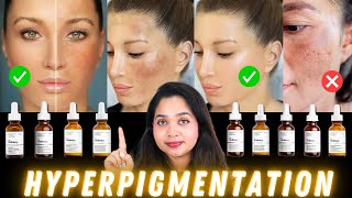 💯 Top Ordinary Skincare For Hyperpigmentation and How to Use Them [upl. by Lipp]