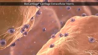 BioCartilage® Cartilage Extracellular Matrix [upl. by Barron]