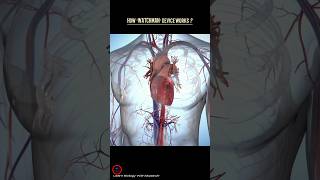 How the WATCHMAN device works  cardiology heart [upl. by Drice]