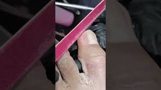 simple cleaning toenail videos pedicure subscribe [upl. by Asilem]