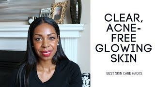 My Skincare Routine For Clear AcneFree Skin [upl. by Skippy]