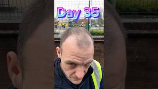 Day 35 Join My Hair Transplant Journey Real Results amp Recovery [upl. by Ainesej]