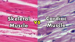 Differentiating Skeletal Muscle and Cardiac Muscle  Striations vs Intercalated Discs [upl. by Richel]