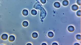 Нейтрофил фагоцитирует бактерию  Bacterial phagocytosis by neutrophil [upl. by Fried]