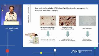 JNPN 2023  Démence ou pathologie psychiatrique [upl. by Oralia758]