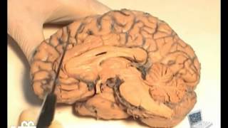 NEUROANATOMIA Anatomia Cerebral [upl. by Lirrehs46]