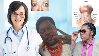 Doctors give a little more insight on Vybz Kartels health condition 😳 GravesDisease VybzKartel [upl. by Netsua91]