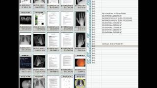 View chest xray side by side [upl. by Nolak880]