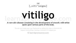 Vitiligo pronunciation and definition [upl. by Neda]