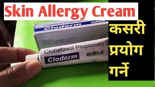 छाला चिलाएमा लगाउने मलमCream for Skin allergyMedicine for itching skincream for dermatitis [upl. by Valle]