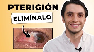 ✅ El MEJOR TRATAMIENTO para el PTERIGIÓN 💡¿Cómo ELIMINARLO con el Método PTR ÚNICO [upl. by Giraldo]