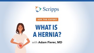 Causes Symptoms and Treatment for Hernias  Ask The Expert [upl. by Alegnat]