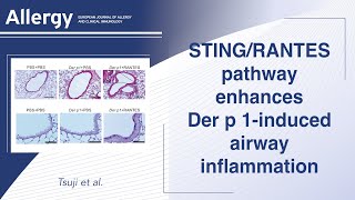 STINGRANTES pathway in airway epithelium enhances Der p1induced airway inflammation [upl. by Darline]