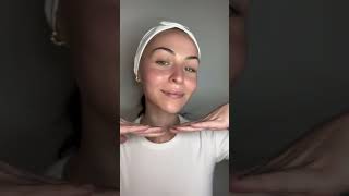 Athome treatment with THIS daily peel combinationskin acne [upl. by Bjorn]