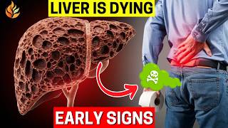 13 Early Warning Signs of Liver Damage You Should Not Ignore [upl. by Funk]