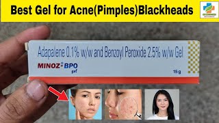 Minoz BPO Gel Use in Hindi  Minoz BPO Gel Benefits Side effects  Acne  Blackheads  SK Medicine [upl. by Rafaelia888]