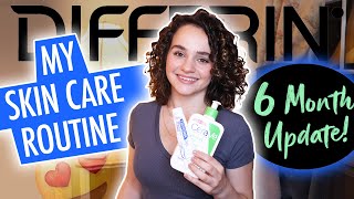 My Skin Care Routine Using Differin and CeraVe  6 Month Update  Carolyn Marie [upl. by Sybyl942]