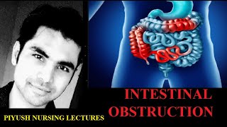 Intestinal obstruction in hindi full leacture [upl. by Haughay325]