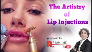 Watch Lip Filling Artistry by Rajani Before and After Lip Filler Portland Oregon [upl. by Hedvig]