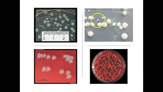 Lab Supplement Colony Morphology [upl. by Lisa]