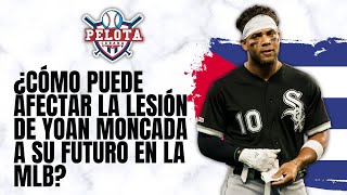 ¿Cómo puede afectar la lesión de Yoan Moncada su futuro en MLB [upl. by Solenne313]