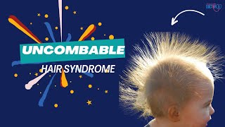 Uncombable Hair Syndrome [upl. by Julianna]