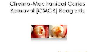 ChemoMechanical Caries Removal CMCR Reagents  Dr Ghousia [upl. by Inajna]