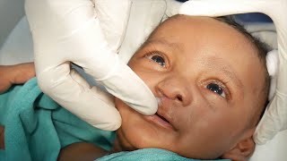 Suture Removal for a Scared Baby after Surgery [upl. by Richelle]