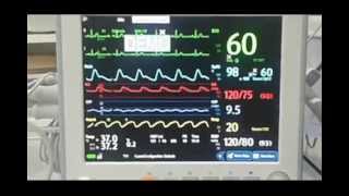 orientation of Data scope monitormindray iPM12 [upl. by Tevlev404]