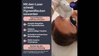 Pigmentflecken entfernen mit Laser in Wien [upl. by Yelmene836]