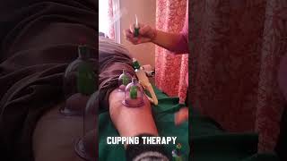 Cupping Therapy cuppingtherapy cupping cuppingmassage [upl. by Aryek]