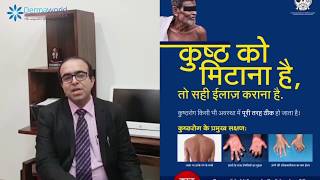 Everything you want to know about Leprosy  कुष्ठ रोग का सही इलाज [upl. by Neltiac]