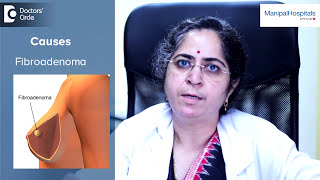 Cancerous Breast Lumps  Breast Lumps Treatment  Dr Poonam Patil  Oncology  Manipal Hospitals [upl. by Saval]