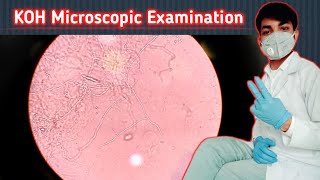 KOH Microscopic Examination  Septate Hyphae fungi  septate and aseptate Hyphae  fungal stain [upl. by Newbill48]