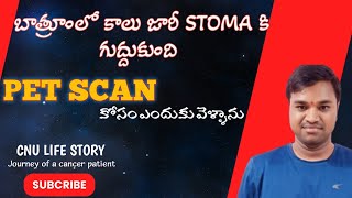 నాకే ఎందుకు ఇలా జరుగుతుంది PET scan కోసం వెళ్తే డాక్టర్ ఏమన్నారు  CANCER CHECKUPS AFTER SURGERY [upl. by Garwin]