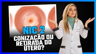 Nic 2 Conização ou retirada do útero [upl. by Losyram]