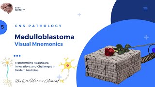 Medulloblastoma Pathology  Visual Mnemonics  Morphology  CNS Pathology  NEET PG USMLE MBBS [upl. by Macey]