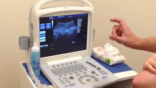 Real Time Ultrasound Rehabilitation of Multifidus [upl. by Nadaba516]