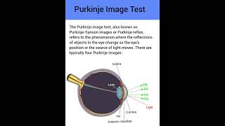 Purkinje image test or purkinje light reflex test in ophthalmology Optometry Fans [upl. by Cleavland502]