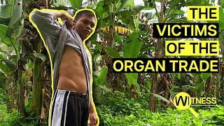 Organ Thieves Inside the Dark World of Organ Trafficking  Organ Trade Documentary [upl. by Kendrah]