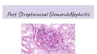 Post Streptococcal Glomerulonephritis PSGN [upl. by Mani227]