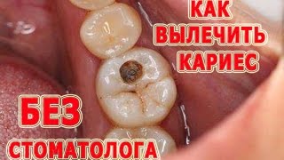 ★Как вылечить кариес без посещения стоматолога и одновременно восстановить зубы Народные методы [upl. by Leanard]