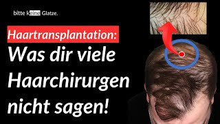 Empfängerbereich Haartransplantation Basic Wissen [upl. by Abernathy]