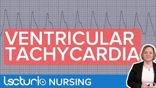 Ventricular Tachycardia ECG Interpretation amp Presentation [upl. by Akired]