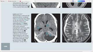 BRAIN DIAGNOSTIC IMAGING SERIES [upl. by Watkins]