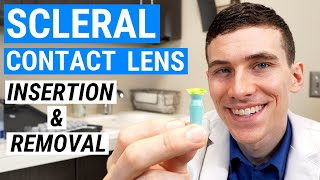 How to Insert and Remove SCLERAL LENSES  Beginners Guide to Scleral Lenses [upl. by Niltak]