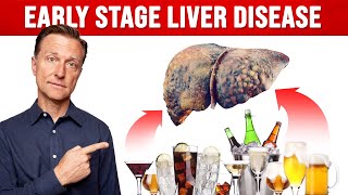 How Much Alcohol Would You Have to Drink Before Liver Damage [upl. by Mavra]